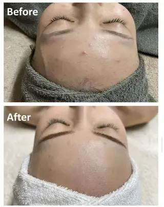 脱毛エステサロン PEAKのエステ・リラクイメージ