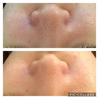 ニキビ/肌質改善専門 Snow skinのエステ・リラクイメージ