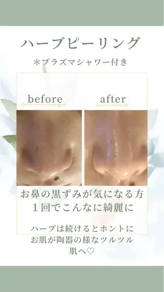 エステfreep takamoriのエステ・リラクイメージ