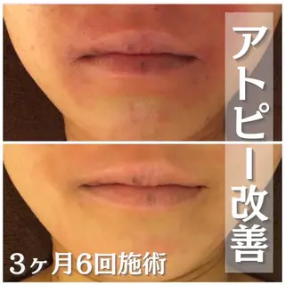 セミロング カラー パーマ ヘアアレンジ メンズ キッズ ネイル マツエク・マツパ アイブロウ 触れたくなる モテ肌へ...❤︎のエステ・リラクイメージ