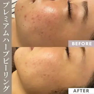 【フェムケア専門店】 PEQLIAヒロミのエステ・リラクイメージ