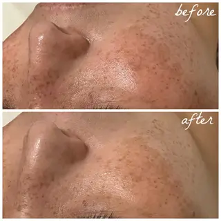 メンズ メナード岐阜市茜部 杉浦のエステ・リラクイメージ