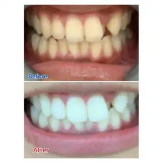 M渋谷店所属・Ｍ渋谷 ホワイトニングのエステ・リラクイメージ