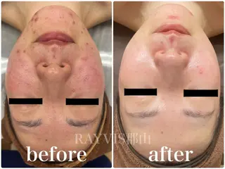 🩵RAYVIS🩵 郡山店のエステ・リラクイメージ