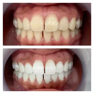 Monreve所属・美人スイッチdiet スーパージェクションのその他イメージ