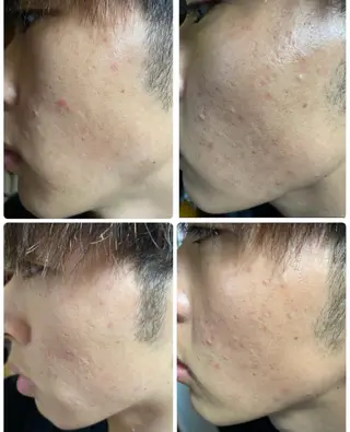 ARONA(アローナ)所属・ARONA ♡のエステ・リラクイメージ