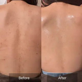 for woman所属・森 美優のエステ・リラクイメージ