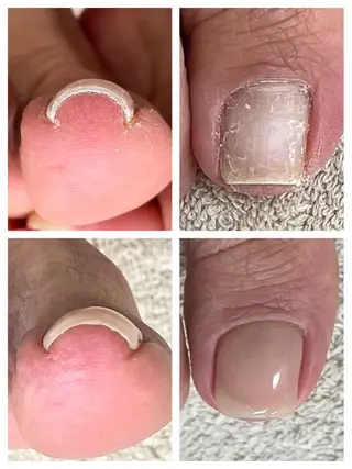 BellaLuna 金子のネイルデザイン