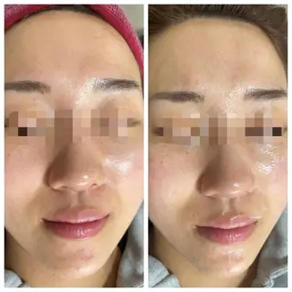 肌質改善サロン facialmoonのエステ・リラクイメージ