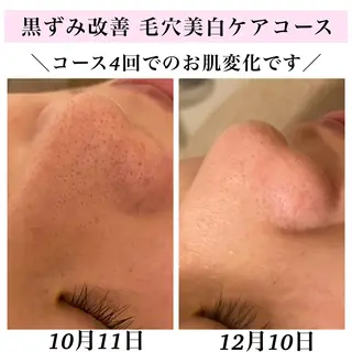 Bellesthe （ベルエステ）のエステ・リラクイメージ