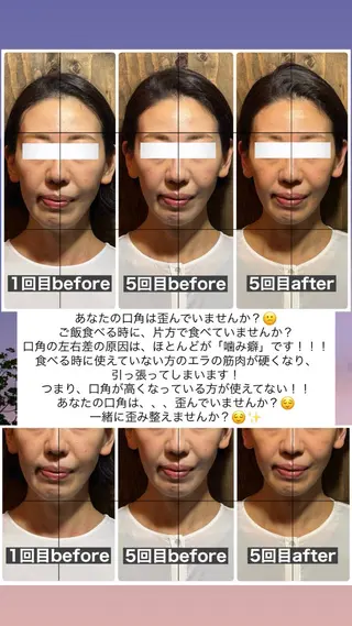 💎後悔させない小顔 矯正💎イトヤマ🌱のエステ・リラクイメージ