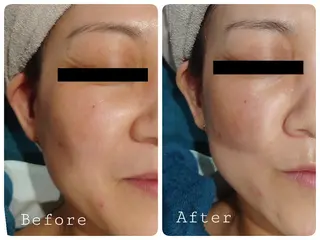 プライベートサロンマリン所属・Private Sa lon MARINEのエステ・リラクイメージ