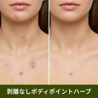 ハーブピーリング肌 管理🌿Ante関内のエステ・リラクイメージ