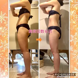 ショート カラー パーマ ヘアアレンジ メンズ キッズ ネイル マツエク・マツパ ‍痩身＆ボディ 結果出し🌟丹野のエステ・リラクイメージ