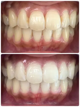 LOVE ホワイトニング戸辺のその他イメージ