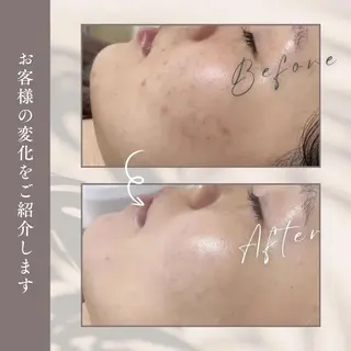 肌管理＆脱毛 美肌専門のエステ・リラクイメージ