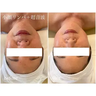 I'm -ｲﾑ-所属・肌質改善／ブライダル I'm.-イム-のエステ・リラクイメージ