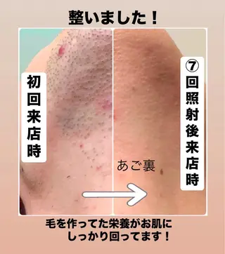 メンズ メンズ脱毛サロン Le falcoのエステ・リラクイメージ