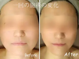 美容整体　D r.MAGICTOUCH所属・劇的小顔・脂肪分解 D rマジックタッチのエステ・リラクイメージ