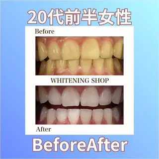 ホワイトニングショップ西原所属・下川 藍子のその他イメージ