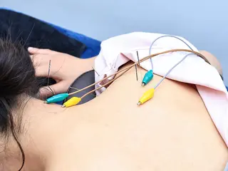 美容鍼・小顔矯正 FLOW 鍼灸整体院のその他イメージ