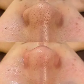 BELCIA福岡店　récolte de BELCIA（レコルトデベルシア）所属・BELCIA福岡店 レコルトデベルシアのエステ・リラクイメージ