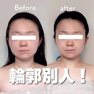 小顔矯正専門店Gémiey所属・越谷駅徒歩３分 小顔専門Gemieyのエステ・リラクイメージ