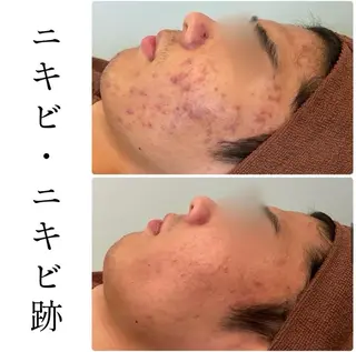 ハーブピーリング専門 BIOPLUS＋川崎のエステ・リラクイメージ