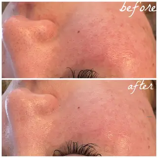 メンズ メナード岐阜市茜部 杉浦のエステ・リラクイメージ