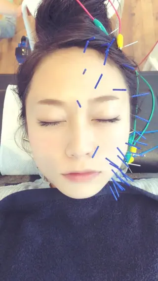 からだサロSUNNY 堺東鍼灸整骨院のエステ・リラクイメージ