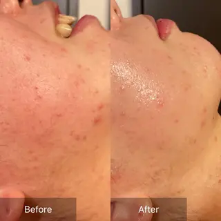 Mandarin Orange所属・毛穴から始める肌メン テマンダリンオレンジのエステ・リラクイメージ