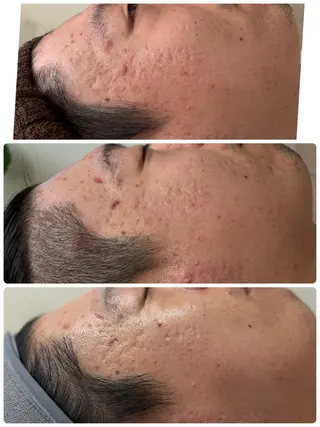 ロミロミ ・艶肌小顔 RIEのエステ・リラクイメージ