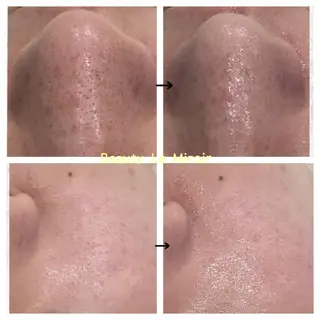 ビューティー ミロワールのエステ・リラクイメージ