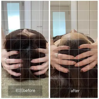 脳洗浄と よもぎ蒸し　Uki.のその他イメージ