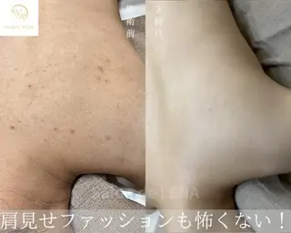 Grandir所属・ハーブピーリング専門 グランディール　武内のエステ・リラクイメージ