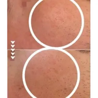 小顔コルギ・美肌 グラシーズのエステ・リラクイメージ