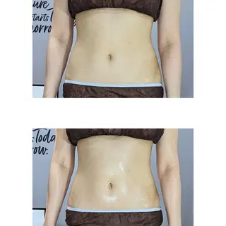 プライベートサロンBRAG所属・プライベートサロン BRAG🏠男女OKのエステ・リラクイメージ