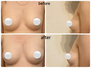 バストアップ専門店HAKU所属・茨田 恵のエステ・リラクイメージ