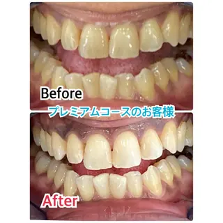 プラチナムビューティー柏所属・【歯科提携】柏ホワイ トニングスタイルのその他イメージ