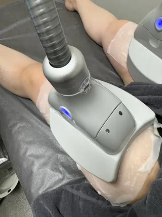 脂肪冷却フェイシャル エスラージュのエステ・リラクイメージ