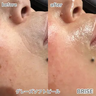 BRISE ブライズのエステ・リラクイメージ