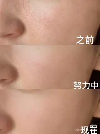 ネイル aliaハイフ&水光ジェットサロン所属・aliaハーブ水光店 エステティシャン募集のエステ・リラクイメージ