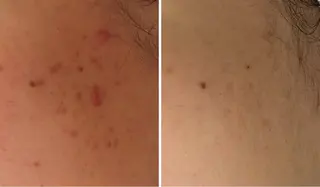 中澤 夢華のエステ・リラクイメージ