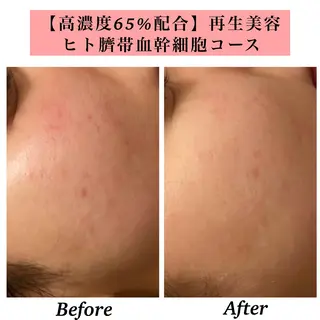 Bellesthe （ベルエステ）のエステ・リラクイメージ