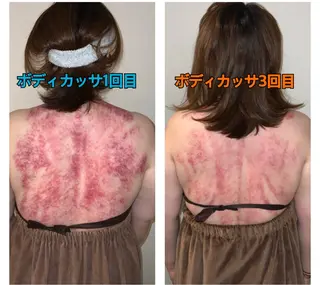 小顔プランナー辰巳 愛美のエステ・リラクイメージ