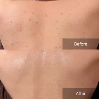 for woman所属・森 美優のエステ・リラクイメージ