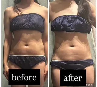 浮腫|肩こり|張り 日々の疲れを解消⭐️のエステ・リラクイメージ