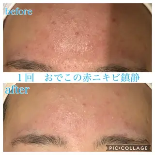 ロング カラー パーマ ヘアアレンジ メンズ キッズ ネイル マツエク・マツパ Ensor Clair所属・EnsorClair 代表　野口真央のエステ・リラクイメージ