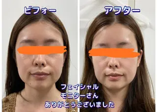 ショールームエステbeco所属・ショールームエステ becoのエステ・リラクイメージ