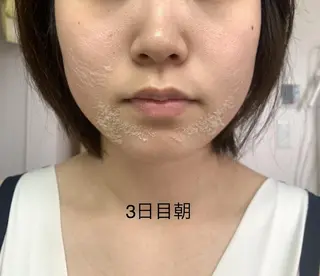 U24限定クーポン レイビス池袋MANAのエステ・リラクイメージ